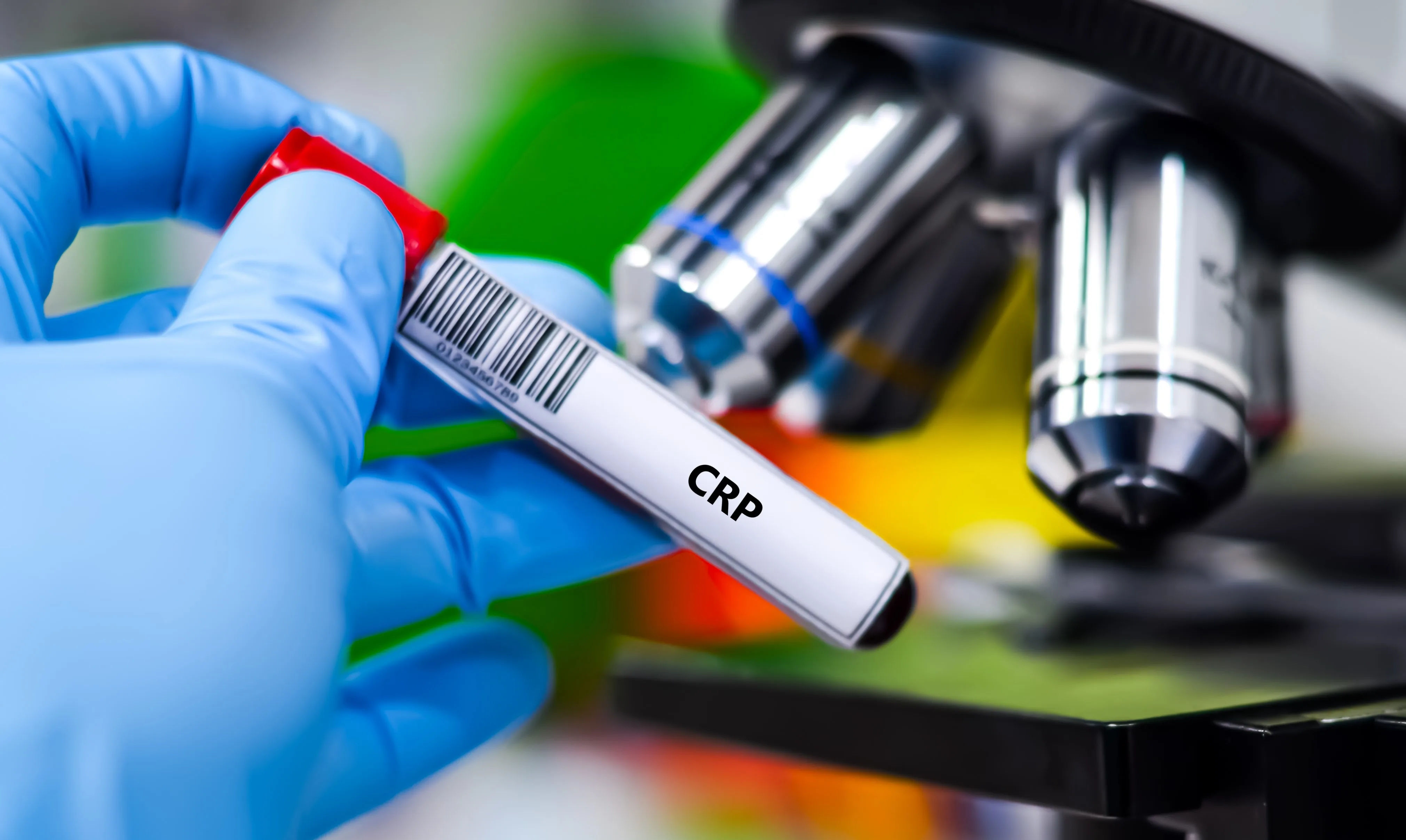 C-Reactive Protein